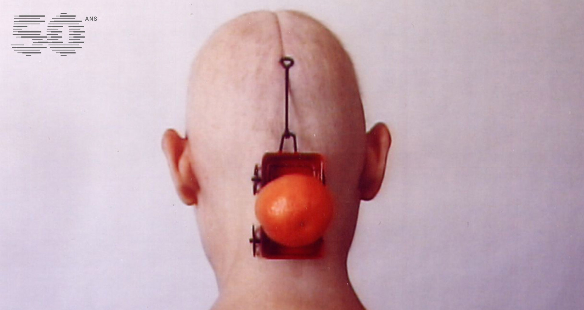 Chantal duPont, Du front tout le tour de la tête, 2000 image couleur, un crane rasé de dos